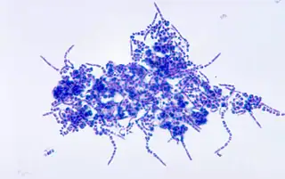 scracthes on horses